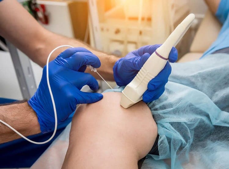 Gloved clinician guiding a needle into a knee using ultrasound