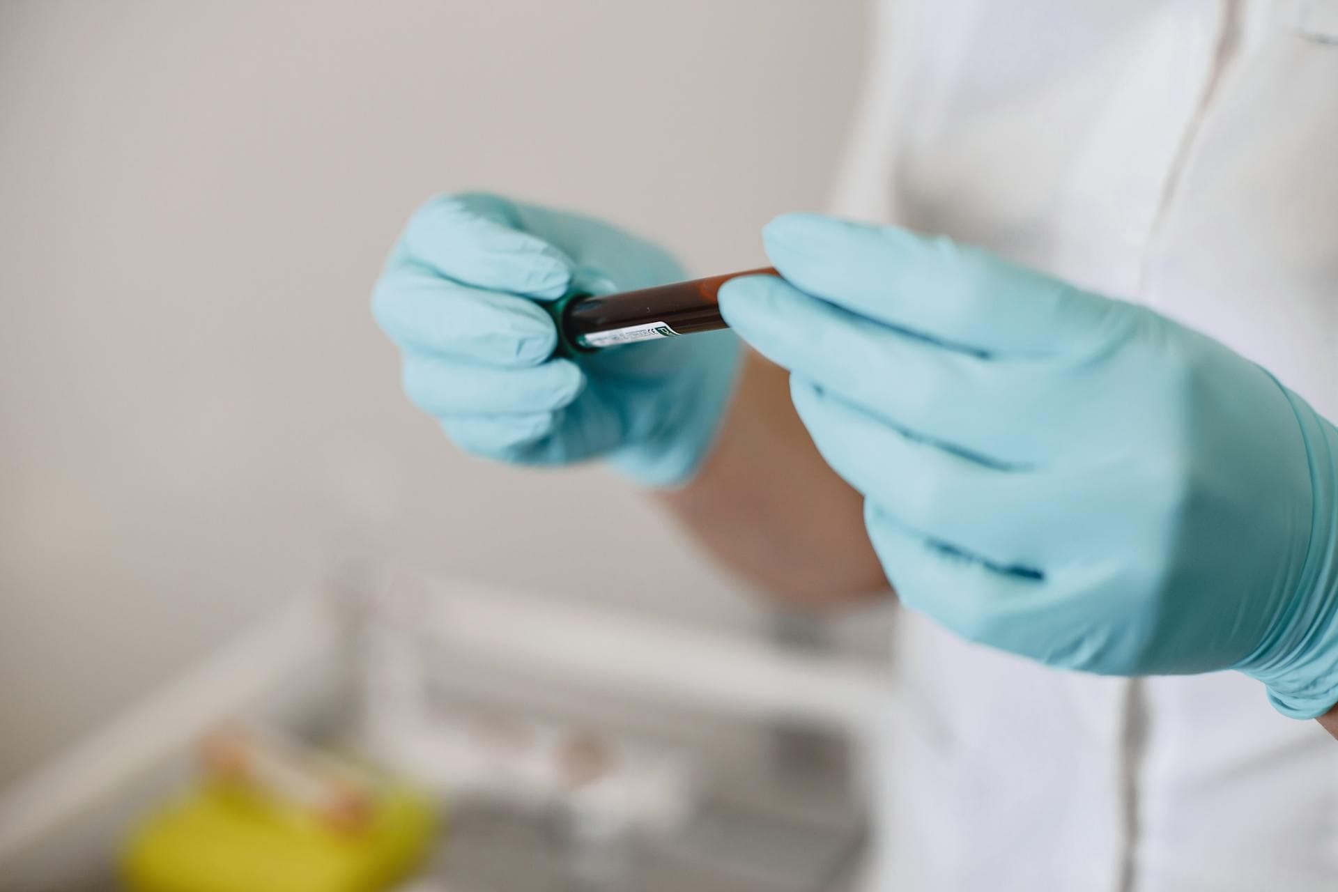 Platelet-rich plasma (PRP) therapy at HTx Pain Institute in Houston